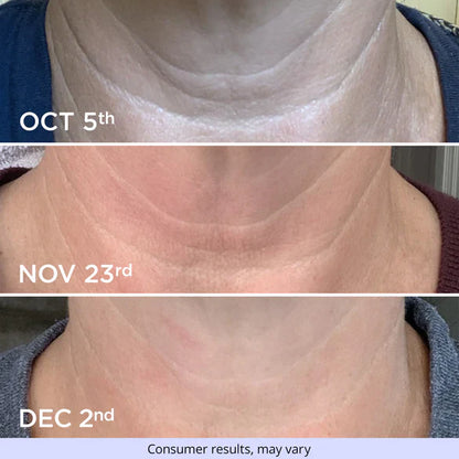 Tighten & Lift Neck Cream